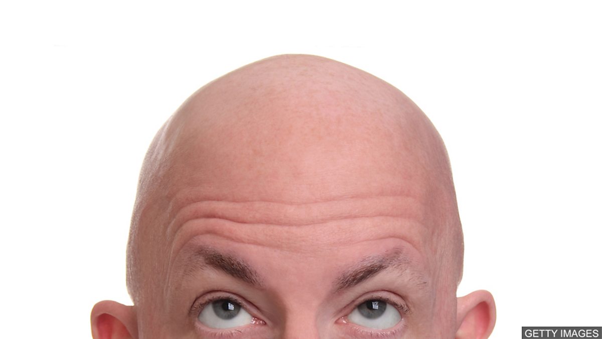 c Learning English 随身英语 Baldness 秃头的烦恼