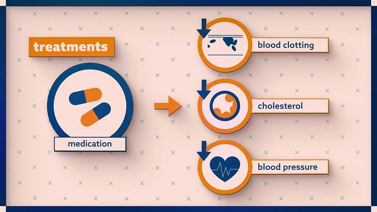 Heart Disease - Causes, effects and management strategies - Global issues: Video playlist - BBC Bitesize