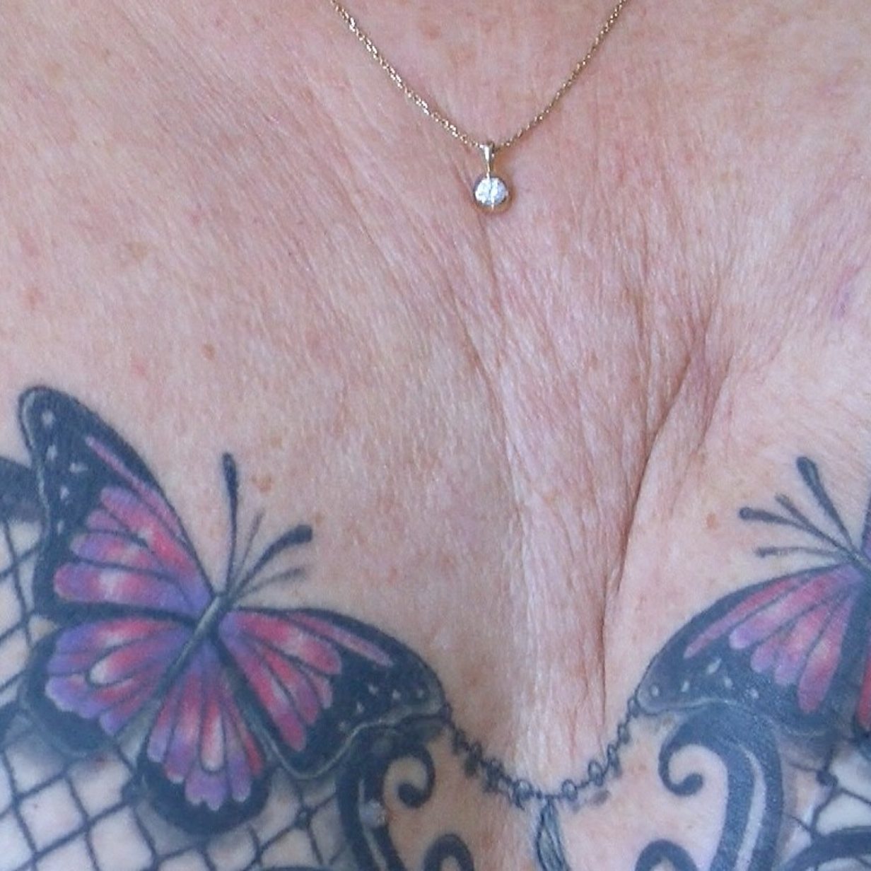 wow how incredible!!!! tattoo of a lace bra on a woman who had a double  mastectomy after implants..very - Illinois Mastectomy fitter (breast  prosthesis for breast cancer survivors)