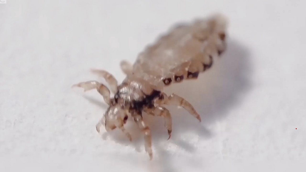 BBC Partners | How do you get head lice? - Health