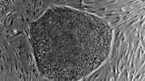 Embryonic Stem Cells