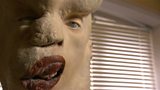 Elephant Man may shed light on causes of cancer