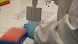 MOTOR NEURONE DISEASE