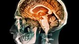 Are we wired differently?