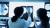 Research to find the cause and ultimately cure for MSA