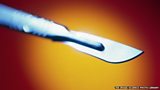 Tackling FGM’s poor prosecution rate