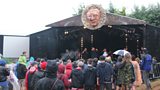 Nozstock