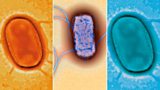 E. coli strain
