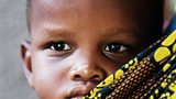 Sight-saving treatment out of reach