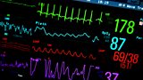 Listen to Nolan callers tell Stephen about their experiences of having a heart attack.