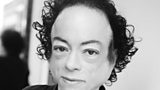 Liz Carr