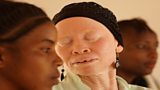 Tanzania Albinism Collective