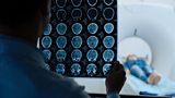 NEUROLOGY RECALL