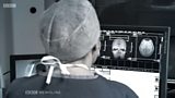 NEUROLOGY RECALL