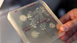 The threat of deadly bacteria