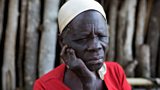 Leprosy: a 21st century disease