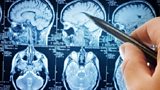 Driving research