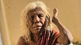 A life destroyed by leprosy