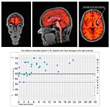 Robert McCrum's brain scan