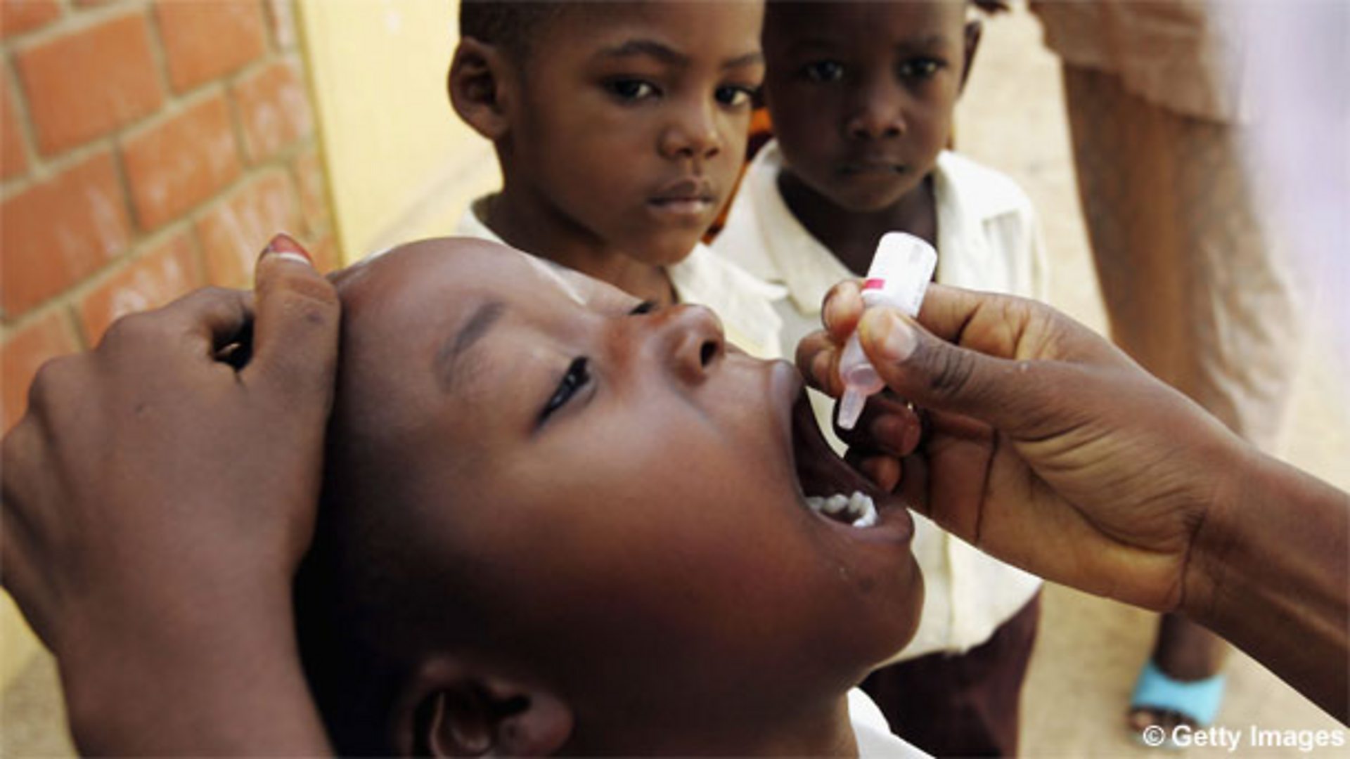 Tackling Polio In Somalia Through Radio 4313