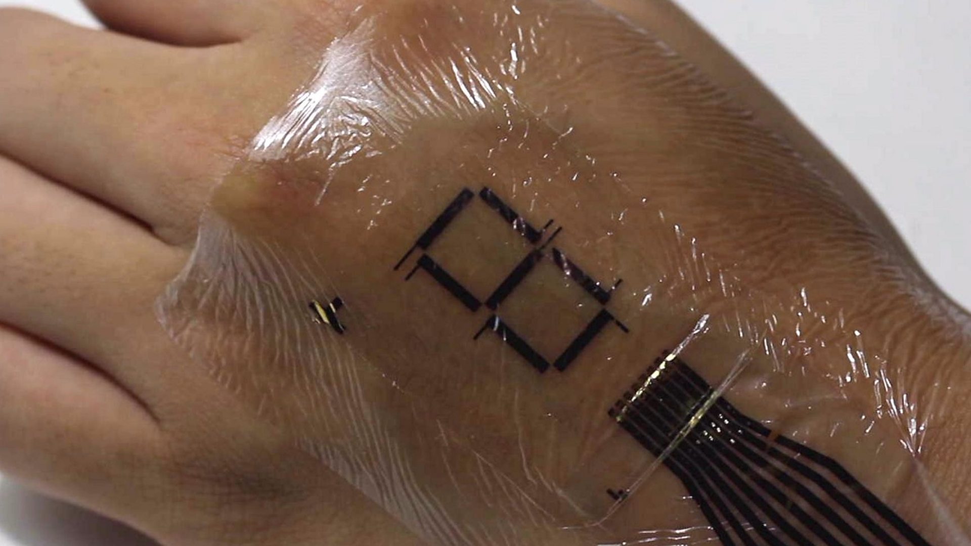 The electronic tattoo that can monitor patient symptoms remotely | Art and  design | The Guardian