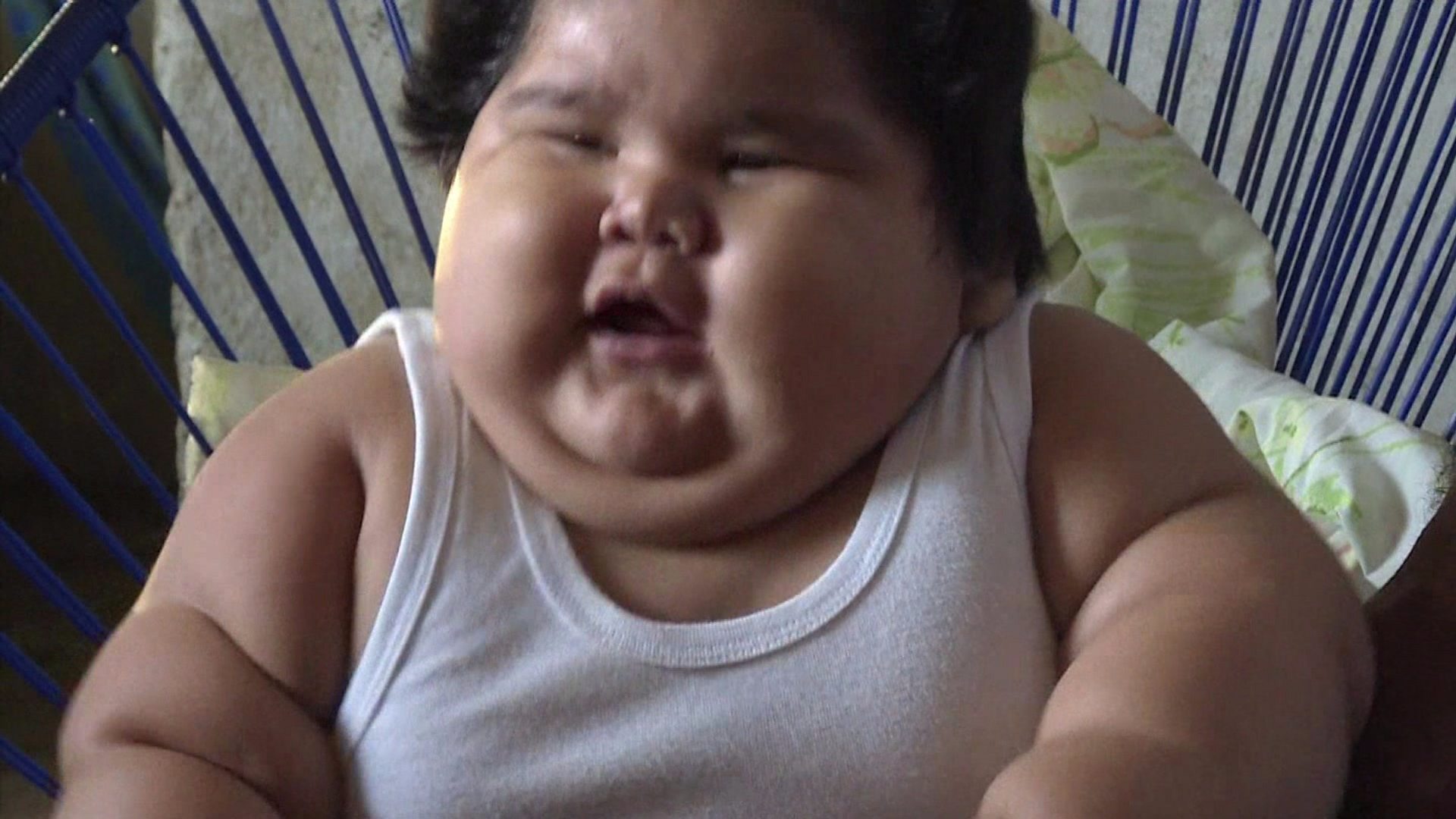 Fat Baby In India Ballooned To 55 Pounds | vlr.eng.br