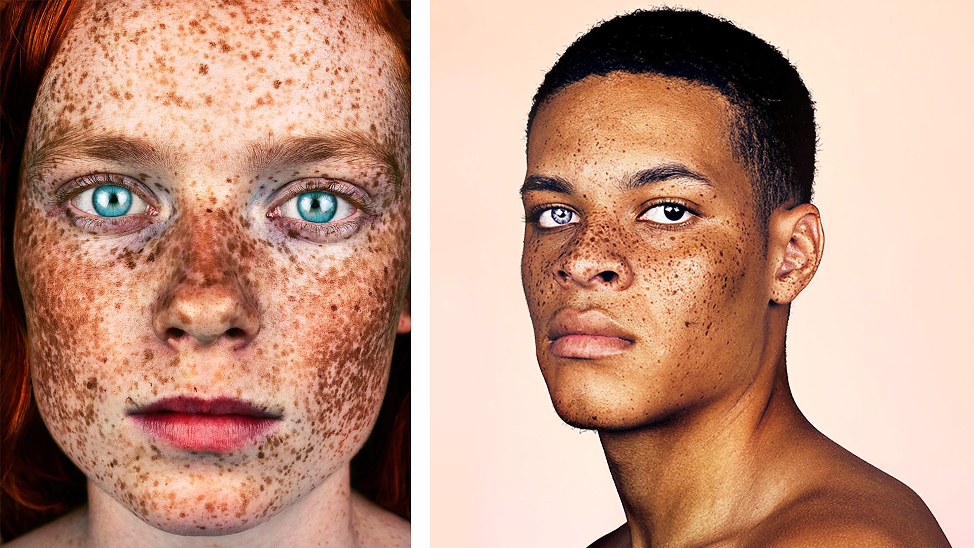 These photos will make you love your freckles - BBC Three