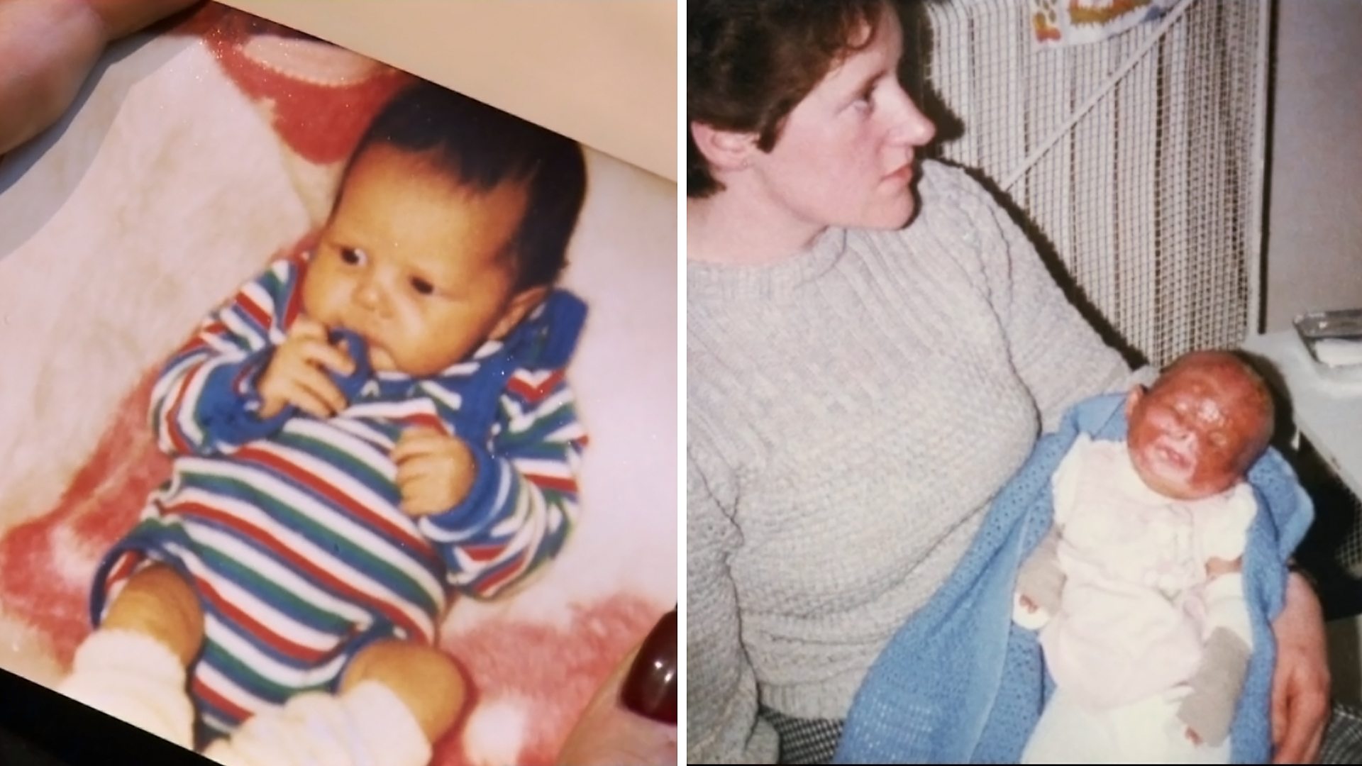 Annie, before and after she was...