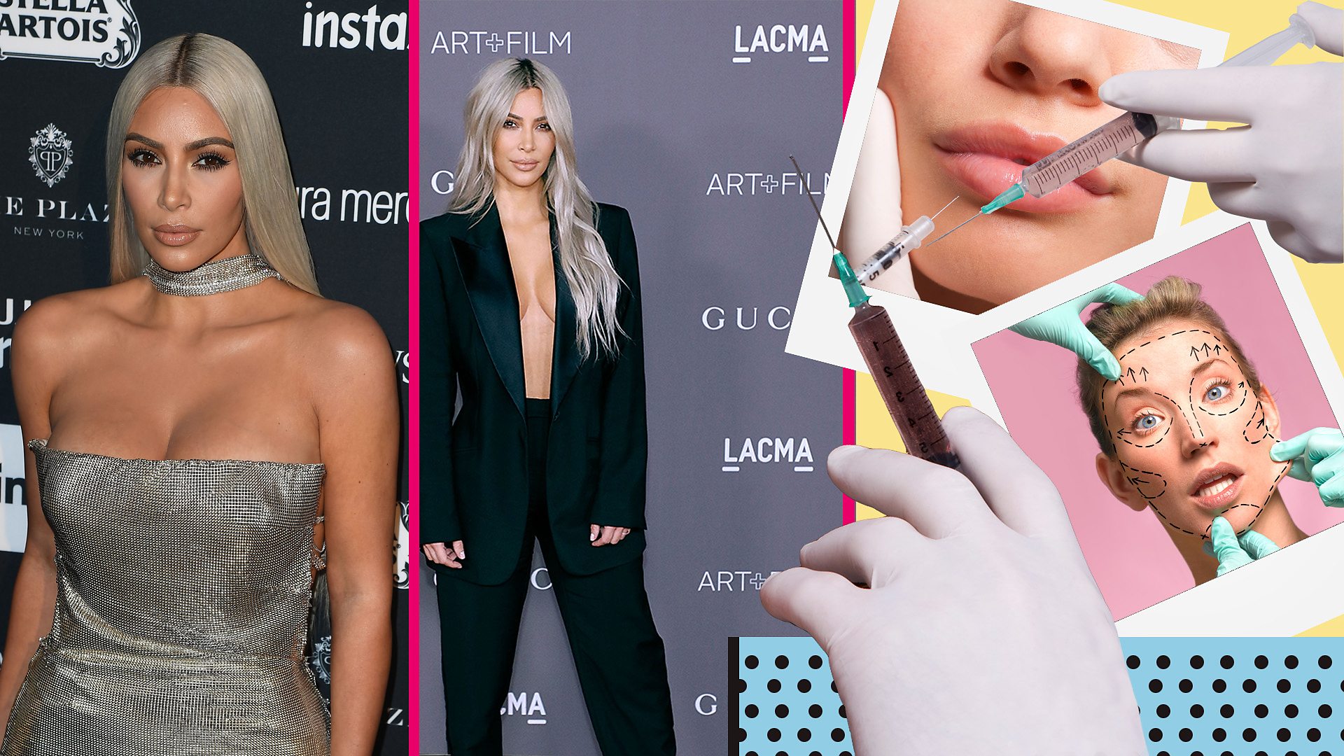 Kim Kardashian posing and images of lip fillers