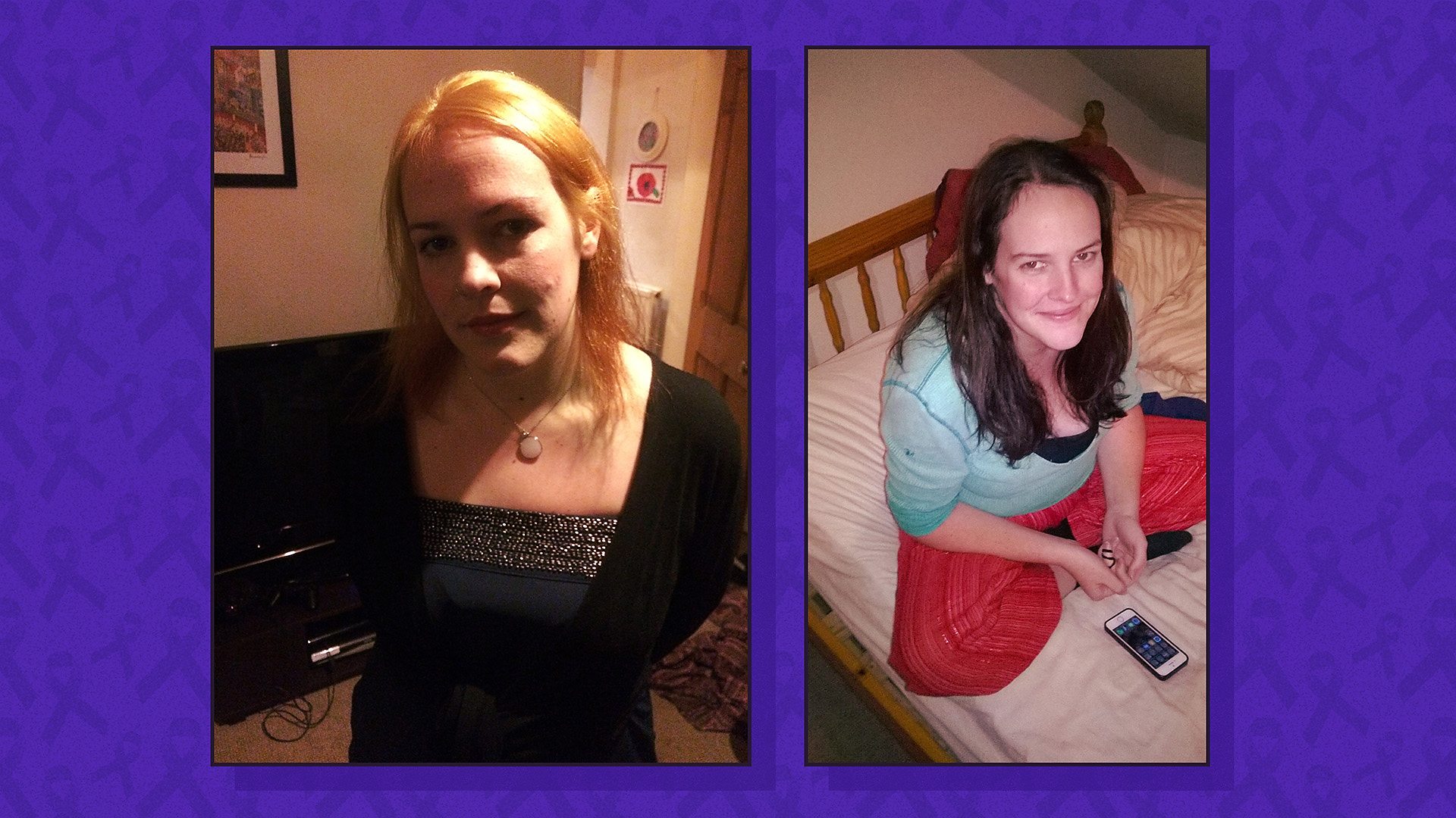 Photos of the contributor after her diagnosis