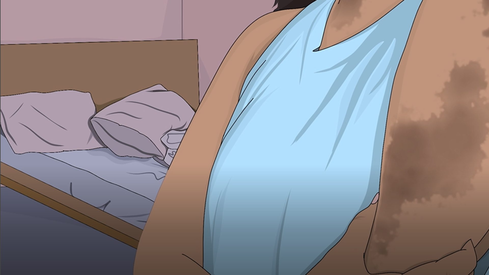 Illustration of a bed and bruises on a woman's arm