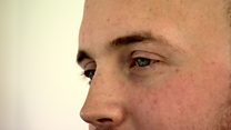 A cure for blindness?