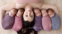 How do you cope with quintuplets?
