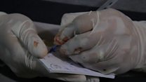 Surgery in Syrian battle zone
