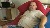 Dystonia: Galw am fwy o gymorth