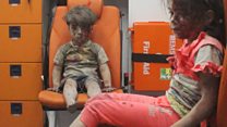 Omran 'is a very lucky child' - doctor