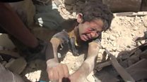 حلب میں بمباری کا شکار بچے