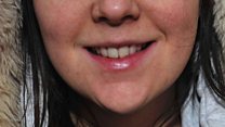 Huddersfield teeth