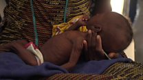 Nigeria's starving children