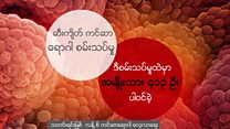 ဆီးကျိတ်ကင်ဆာ ကုထုံးနည်းသစ်