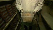 Call for brain donors