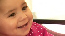 Surgeon seeks Syrian baby he helped