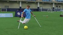 Man City's amputee football star