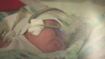 Babies 'as little as one pound' surviving