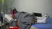 Daawo: Soomaalidii ku dhaawacantay weerarkii doonta Yemen oo hadlay