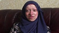 تتلی کے پروں جیسی نازک جِلد