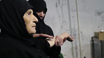 Treating cancer in a warzone