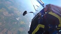 Woman with 'butterfly skin' skydives
