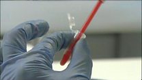 Les maladies tropicales négligées reculent enfin