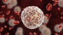 Could a rogue immune system cause depression?